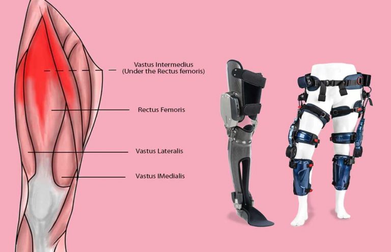 Knee braces for people with IBM