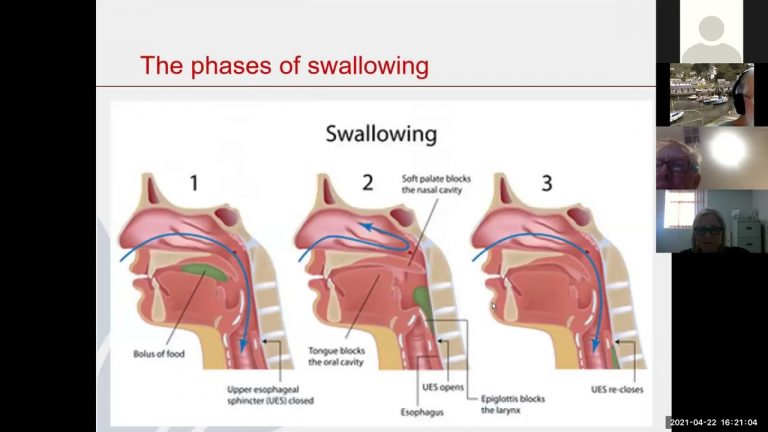 Swallowing & Myositis